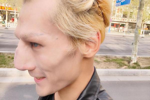 误区揭秘：鼻子白毛暗藏玄机，如何改变你的命运？