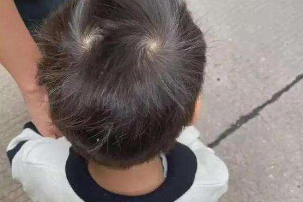 头上四个旋背后的命运密码，你知道吗？