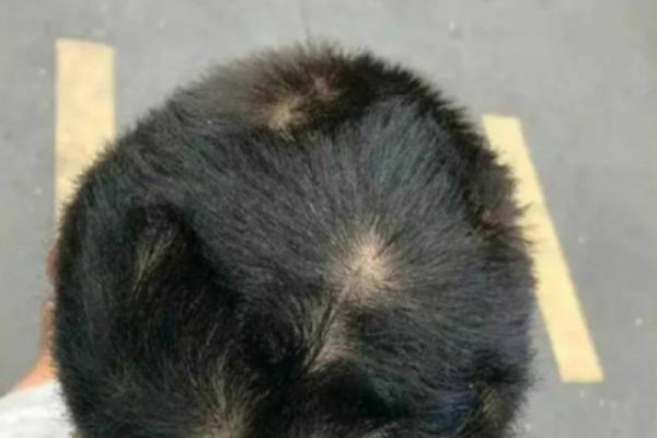 头上四个旋背后的命运密码，你知道吗？