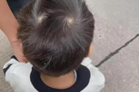 头上四个旋背后的命运密码，你知道吗？
