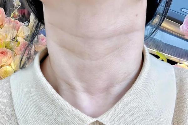 颈纹背后隐藏的命运玄机,如何破解? 颈纹背后隐藏的命运玄机,如何破解?