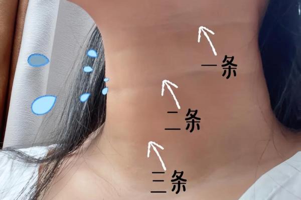 颈纹背后隐藏的命运玄机,如何破解? 颈纹背后隐藏的命运玄机,如何破解?