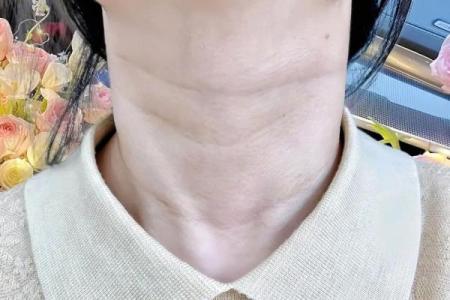 颈纹背后隐藏的命运玄机,如何破解?